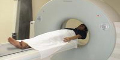 Tomografide kanser riski