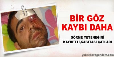 Bir Göz Kaybı Daha