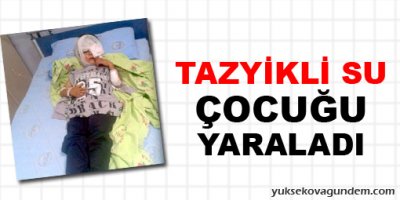 Tazyikli su çocuğu yaraladı