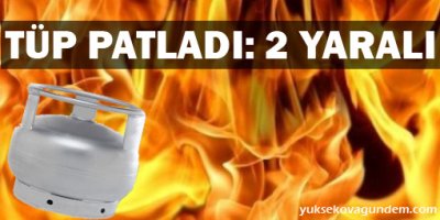 Tüp patladı: 2 yaralı