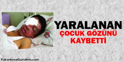 Yaralanan çocuk gözünü kaybetti
